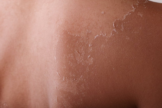 肌のターンオーバーとは?