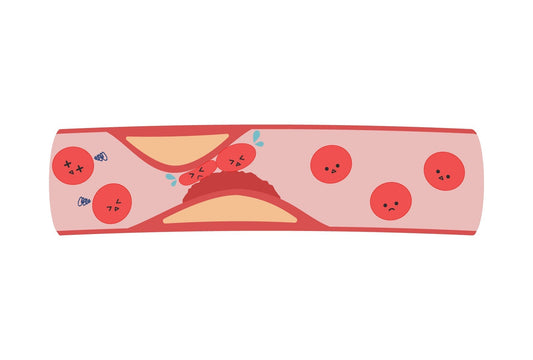 そのコレステロール制限、意味ありませんー正しいコレステロールの下げ方ー